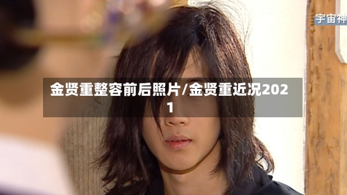 金贤重整容前后照片/金贤重近况2021