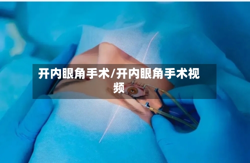 开内眼角手术/开内眼角手术视频-第3张图片