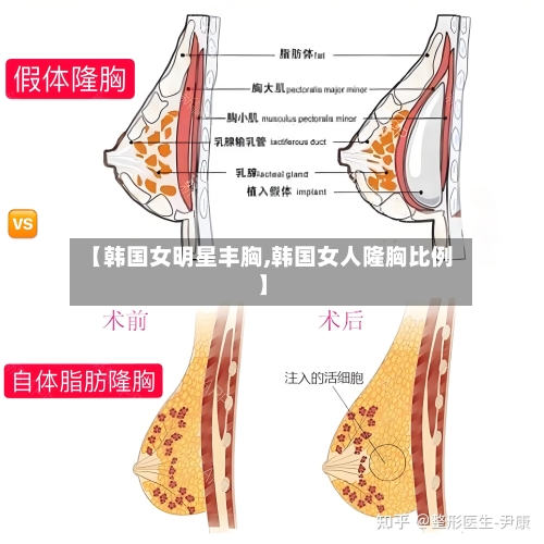 【韩国女明星丰胸,韩国女人隆胸比例】-第3张图片